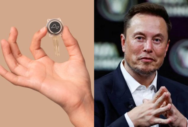 Elon Musk Neuralink’s First-Ever Human Brain Chip Implant