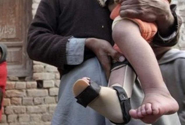 PMA concerned over reporting of polio case from Balochistan