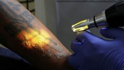 Indonesia authorities provide free tattoo removal services for Muslims