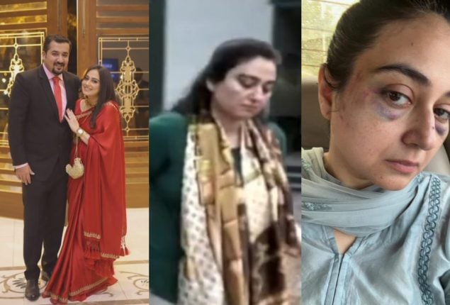 Ayesha Jahanzeb is brutally attacked by husband