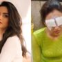 Jasmin Bhasin Faces Severe Corneal Damage from Contact Lens Mishap
