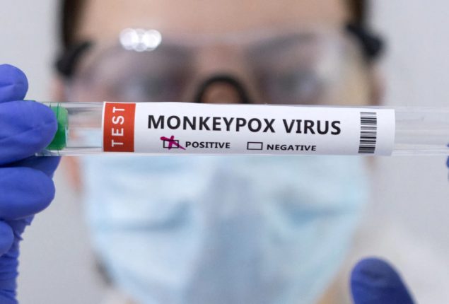 EU health agency urges Europe to prepare for more Monkey pox cases