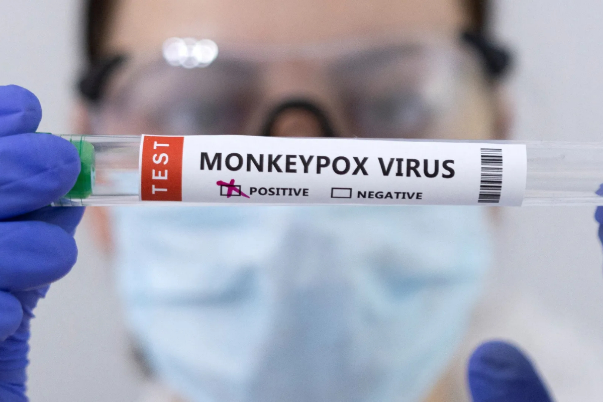 EU health agency urges Europe to prepare for more Monkey pox cases