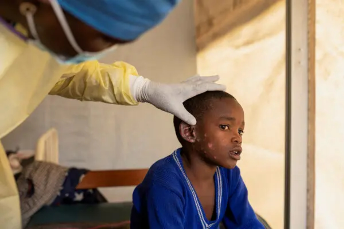 WHO grants approval for first Mpox vaccine to strengthen disease control in Africa