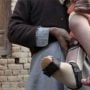 Another polio case reported in Karachi