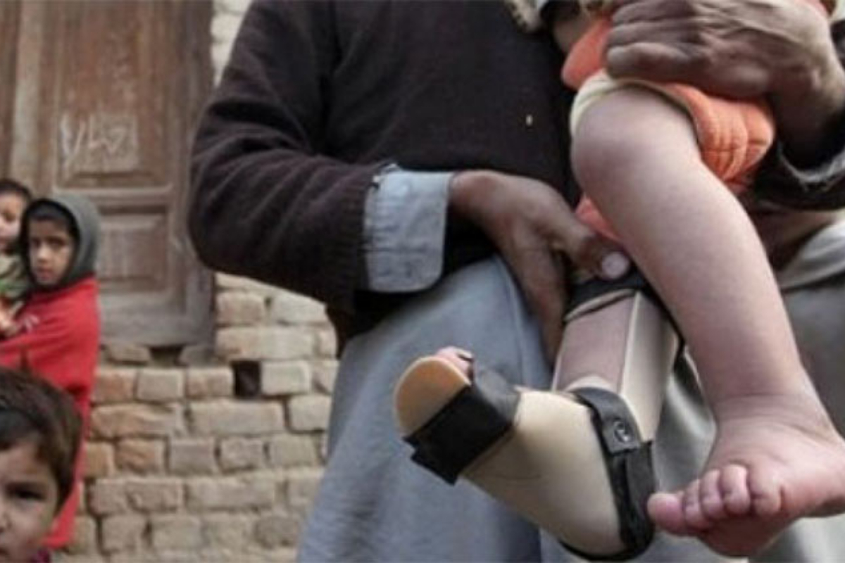 Another polio