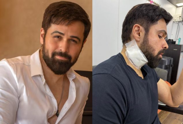 Emraan Hashmi sustains injuries while shooting for ‘Goodachari 2’