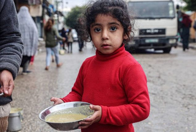 UN reports Gaza holds world's highest rate of child amputees per capita