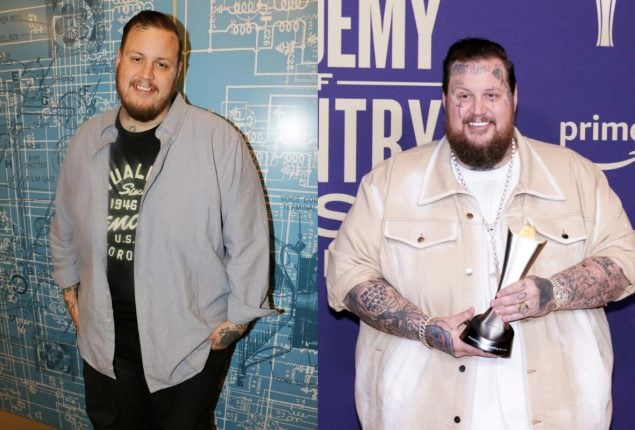 Jelly Roll shares his battle with food addiction and 110-Lb. weight loss journey