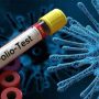 Polio virus detected in sewage of 14 districts across Pakistan