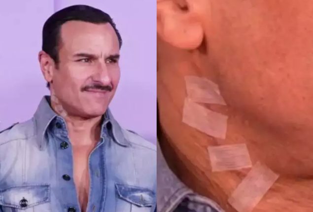 Saif Ali Khan’s visible neck scars go viral in first public appearance after attack