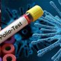 Poliovirus detected in sewerage samples of all four provinces