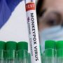 Pakistan confirms two more Monkeypox cases