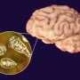 Naegleria Fowleri claims woman life in Karachi