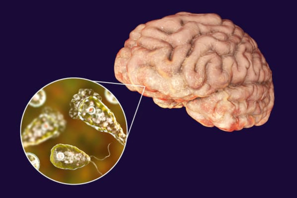 Naegleria Fowleri