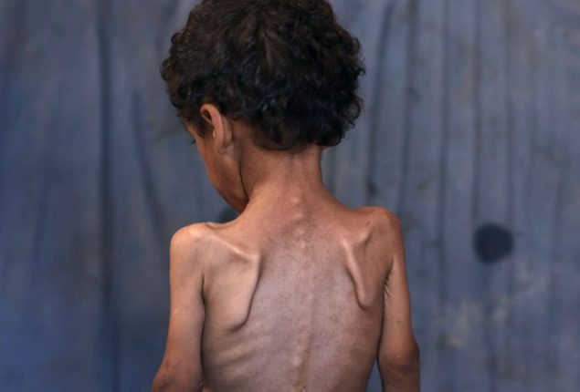 Britain, France, and Germany demands for immediate end to Gaza humanitarian crisis