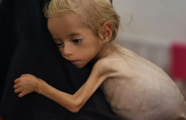 Starvation crisis in Gaza: 100 children dead amid Israel blockade
