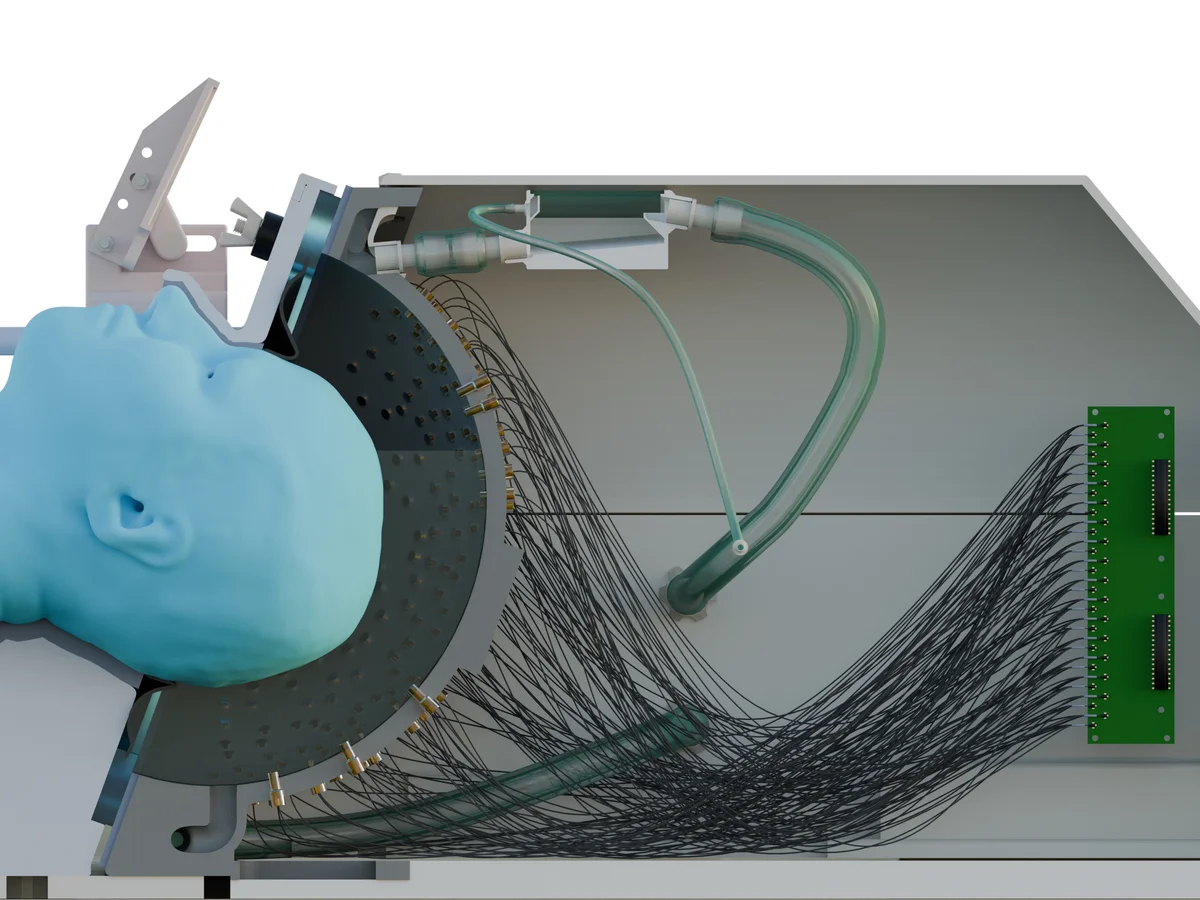 British scientists develop ultrasound helmet for Non-Surgical brain treatment