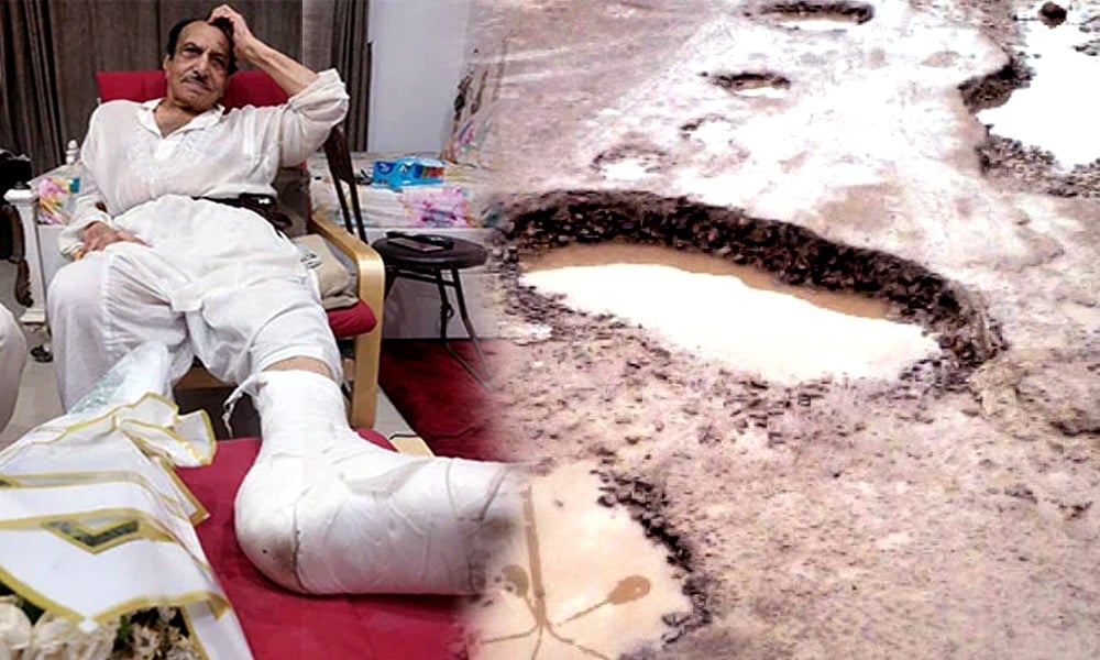 Veteran actor Mustafa Qureshi fractures Leg in road accident
