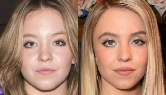 Euphoria star Sydney Sweeney speaks out against cosmetic surgery