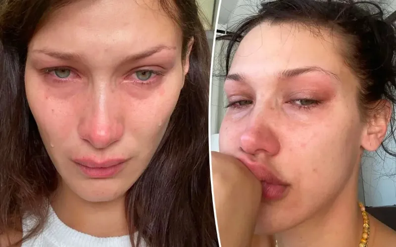Bella Hadid speaks about painful health struggles and daily life