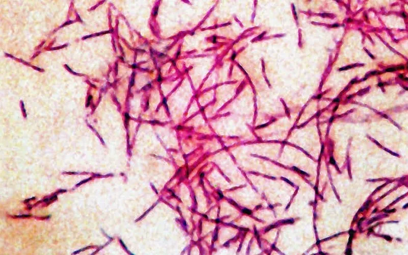 NYC reports three deaths in Legionnaires’ outbreak