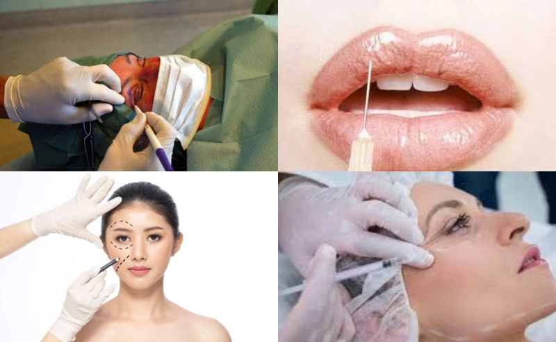 Countries with the highest cosmetic surgery rates