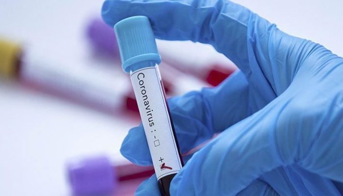 Pakistan coronavirus cases